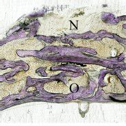 Longitudinal Histological Sections Of The Distracted Side Toluidine