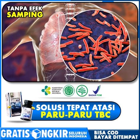 Jual Obat Spesialis Tbc Paru Paru Basah Alami Bronkitis Asma Sesak