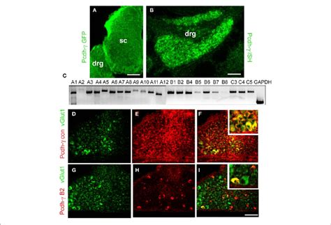 Expression Of Pcdhs By Drg Sensory Neurons A Anti Gfp Staining