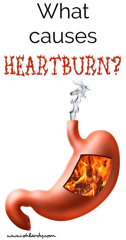 Best Foods For Heartburn Artofit