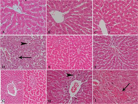 A Photomicrograph Of Liver Tissue Sections From A Liver Of The Download Scientific Diagram