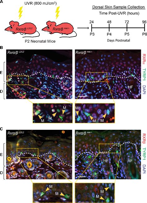 Figure 1 from Retinoid X Receptors α β in Melanocytes Modulate Innate