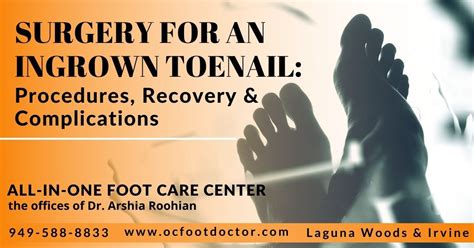 Surgery For An Ingrown Toenail Procedures Recovery Complications