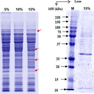 12 SDS PAGE Profile Of Cellular And Extracellular Proteins Of