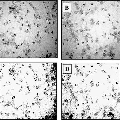 Effect Of Hypoxic Preconditioning On Expression Of Tnf Type 1 Receptor