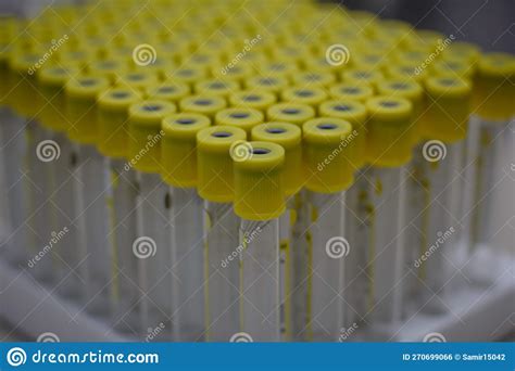 Test Tubes For Biochemical Blood Tests Are On The Table In The