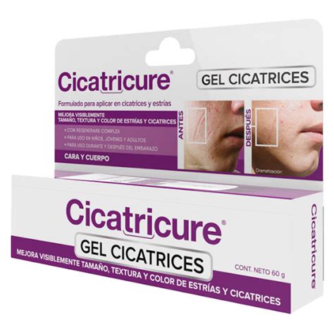 Gel Cicatricure Cicatrices Y Estrías 60 G Gestor De Salud