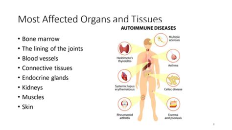 Autoimmunity Flashcards Quizlet