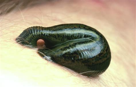 Medicinal Leech Photograph by Martin Dohrn/science Photo Library - Fine ...