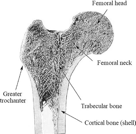 Cortical And Trabecular Bone Distribution In The Human Proximal Femur