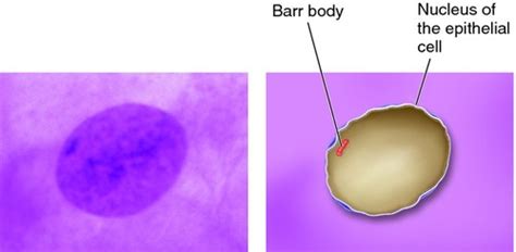 Sex Chromosomes And Determination Flashcards Quizlet