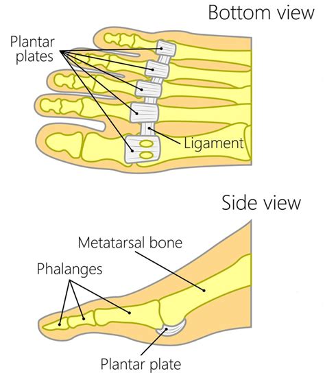 flexor hallucis longus tendon pain