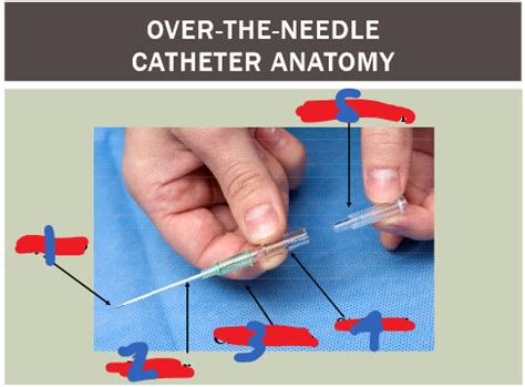 Intubation IV And IO Catheters Not Finished Flashcards Quizlet