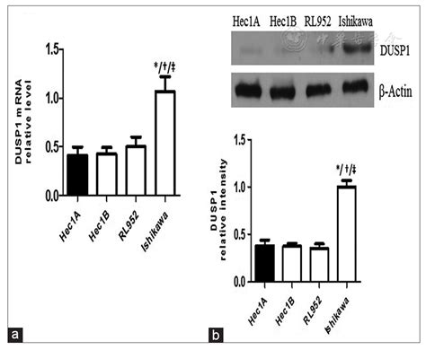 Dual Specificity Phosphatase 1 Deficiency Induces Endometrioid