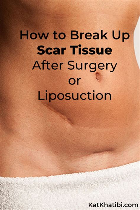 How To Break Up Scar Tissue After Surgery or Liposuction | Kat Khatibi ...