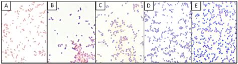 Serratia Marcescens Gram Stain