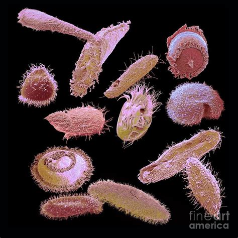 Ciliate Diversity Photograph By Steve Gschmeissnerscience Photo Library Fine Art America