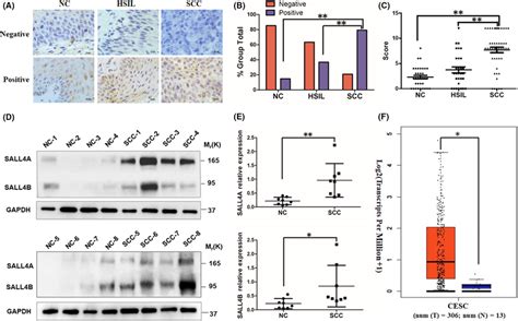 Sall4 Expression In Samples Of Normal Cervix And Various Cervical