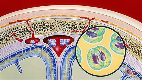 Bacterial Meningitis: Types, Symptoms, Causes, and Treatment | Everyday Health