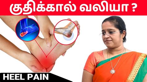 Heel Pain Plantar Fasciitis In Tamil Dr A