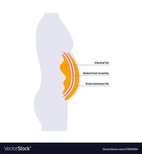 Visceral Fat Diagram Royalty Free Vector Image