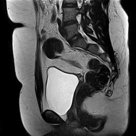 Radiology Quiz 93133 Radiopaedia Org