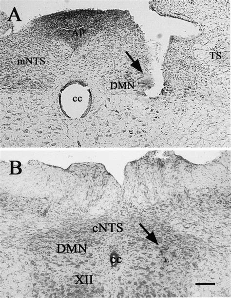 Location of the injection site (arrow) in intermediate (A) and caudal ...