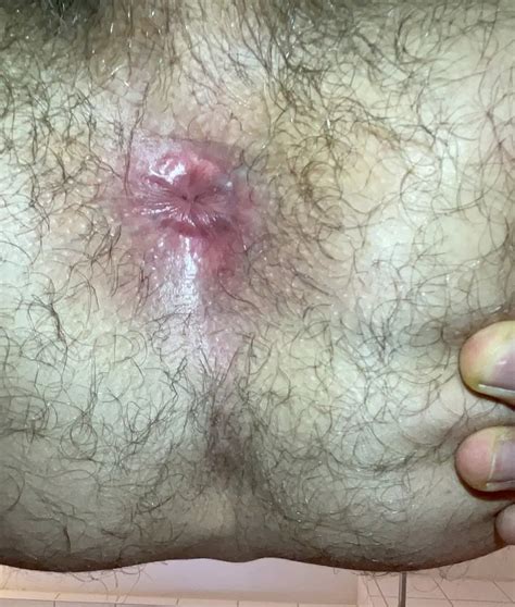 My Hairy Asshole Nude Pics XHamster