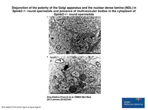 Disjunction Of The Polarity Of The Golgi Apparatus And The Nuclear