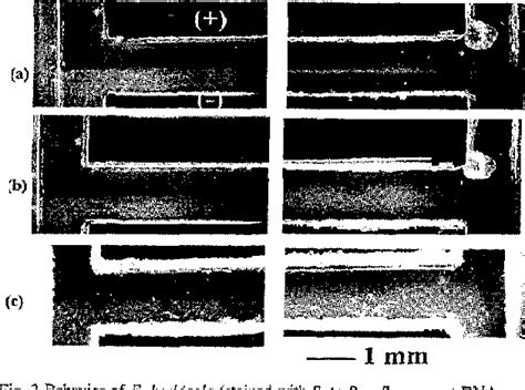 Figure 2 From Use Of Isoelectric Focusing For Sample Preconditioning In