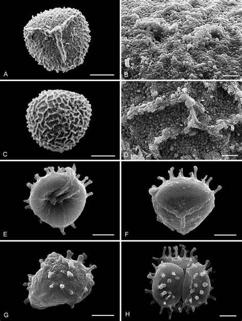 Scanning Electron Micrographs Of Megaspores And Microspores Of