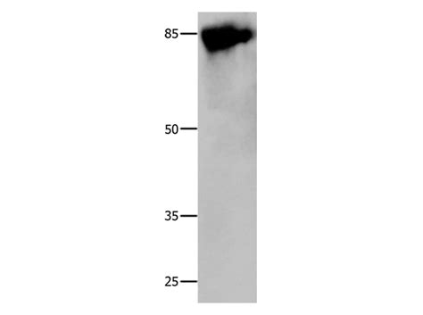 Polyclonal Cald1 Antibody MyBioSource