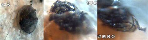 Morgellons Microscope Pictures #4