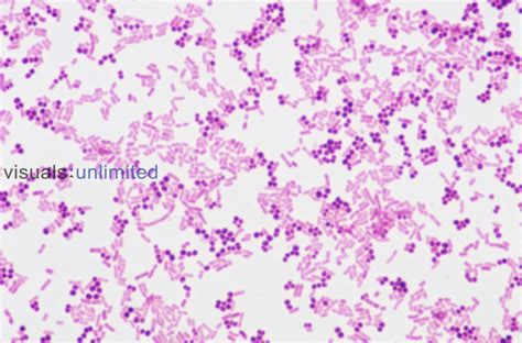 Gram staining series | Visuals Unlimited