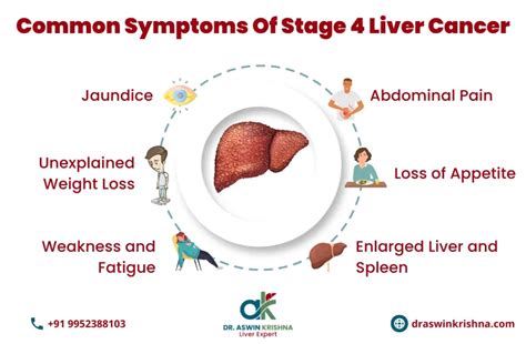 Best Liver Cancer Treatment In Chennai 100 Expert Care