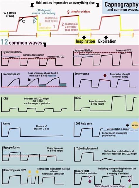 Capnography Waveforms Nurse Anesthesia Emergency Nursing Anesthesia