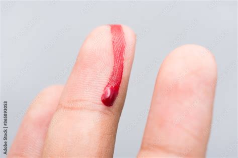 Foto De Bleeding Blood From The Cut Finger Wound Injured Finger With