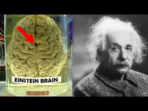 Albert Einstein Einstein Brain Stolen Einstein Brain Techbye