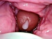 Cum Inside Me Over And Over Camera Inside Vagina Creampie Cervix Pov Xxx Mobile Porno Videos