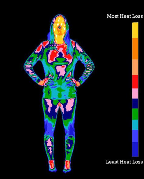 Pin On Thermosurvey Medical