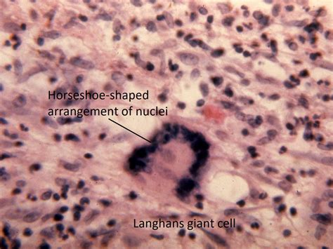 Moran Core Cellular Histopathology