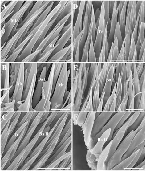 Scanning Electron Micrographs Of Trichoid Sensilla And Basiconic