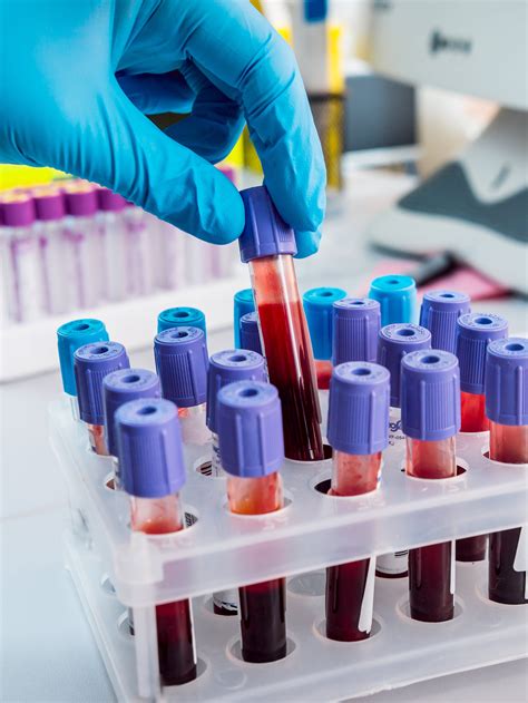 Specific Blood Tests – La Rose Clinic