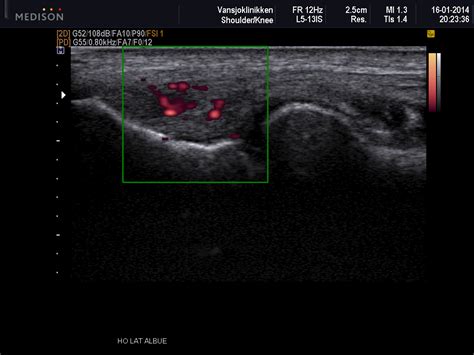 Diagnostisk Ultralyd Vansj Klinikken