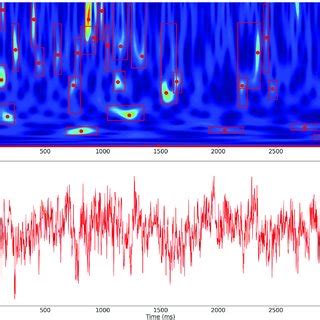 Locations Of The IEEG Electrodes Used For Human Electrophysiology