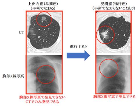ct ct lkuci