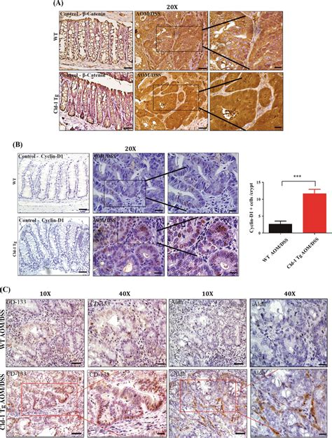 β Catenin Signaling Is Activated In Cld 1 Tg Mice A Representative Download Scientific Diagram