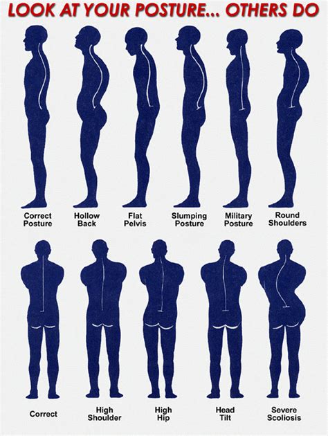 Look At Your Posture Better Posture Posture Fix Good Posture