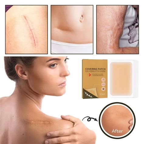 Pcs Invisible Tattoo Scar Acne Cover Up Sticker Concealer Skin