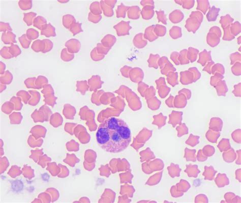 Figure Anaplasma Morula In An Eosinophil Of A Cat With Anaplasma